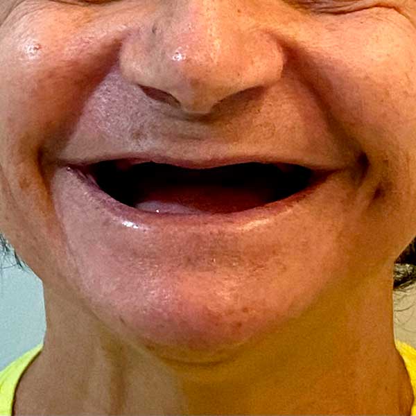 clinica-de-odontologia-em-campina-grande,-dentista-em-campina-grande,-implante-dentario,-implante-dentario-em-campina-grande,-protese-dentaria,-dra-marilia-pessoa-t1 clinica-de-odontologia-em-campina-grande,-dentista-em-campina-grande,-implante-dentario,-implante-dentario-em-campina-grande,-protese-dentaria,-dra-marilia-pessoa-t1