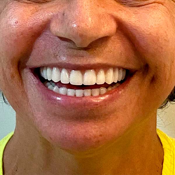 clinica-de-odontologia-em-campina-grande,-dentista-em-campina-grande,-implante-dentario,-implante-dentario-em-campina-grande,-protese-dentaria,-dra-marilia-pessoa-t2
