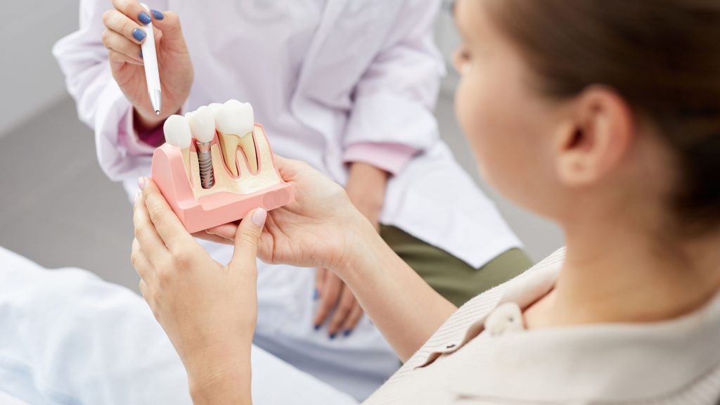 como é colocado o implante dentário, dentista em campina grande, melhor dentista em campina grande, implante dentario, clínica odontológica campina grande