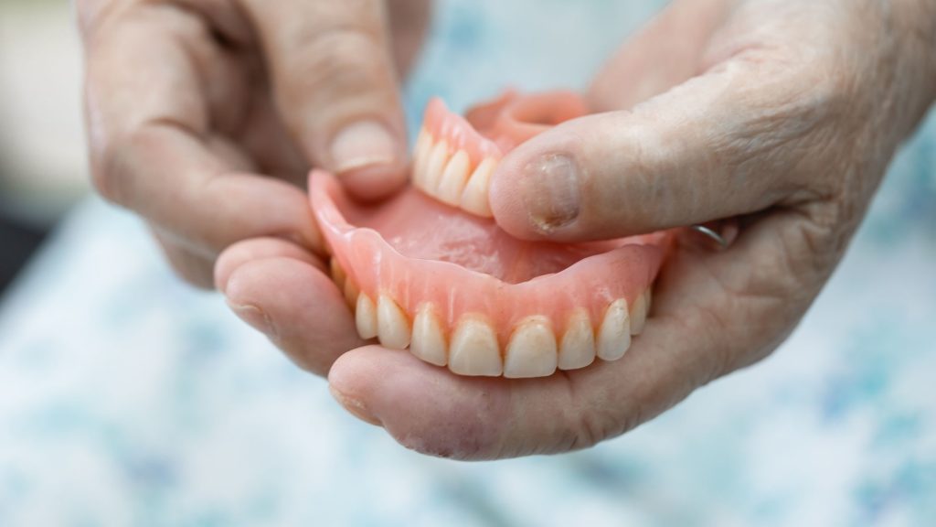 implante ou dentadura, dentista em campina grande, melhor dentista em campina grande, implante dentario, clínica odontológica campina grande
